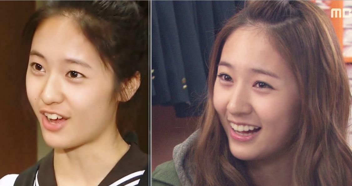 These 16 Before Photos Of Idols Teeth Will Leave Your Jaw Hanging