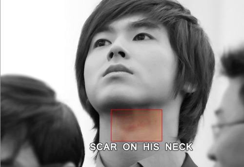 yunho neck