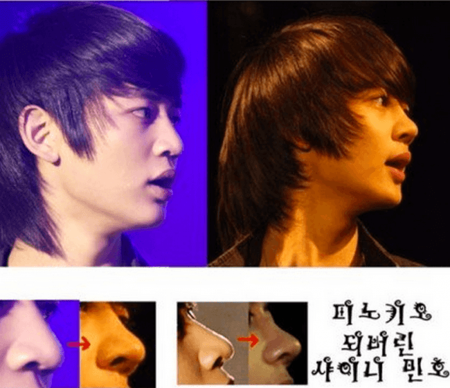 SHINee Minho’s nose became like Pinocchio 
