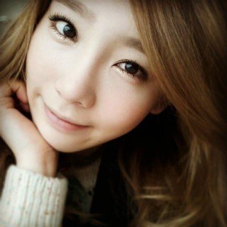 taeyeon double eyelid