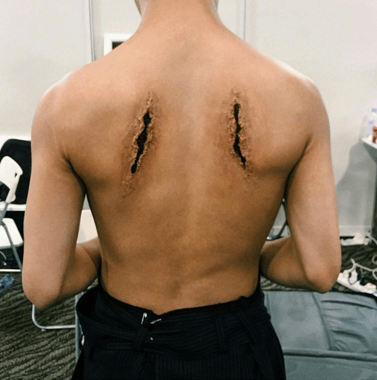 Here’s how BTS V got those cuts on his back during MAMA 2016.