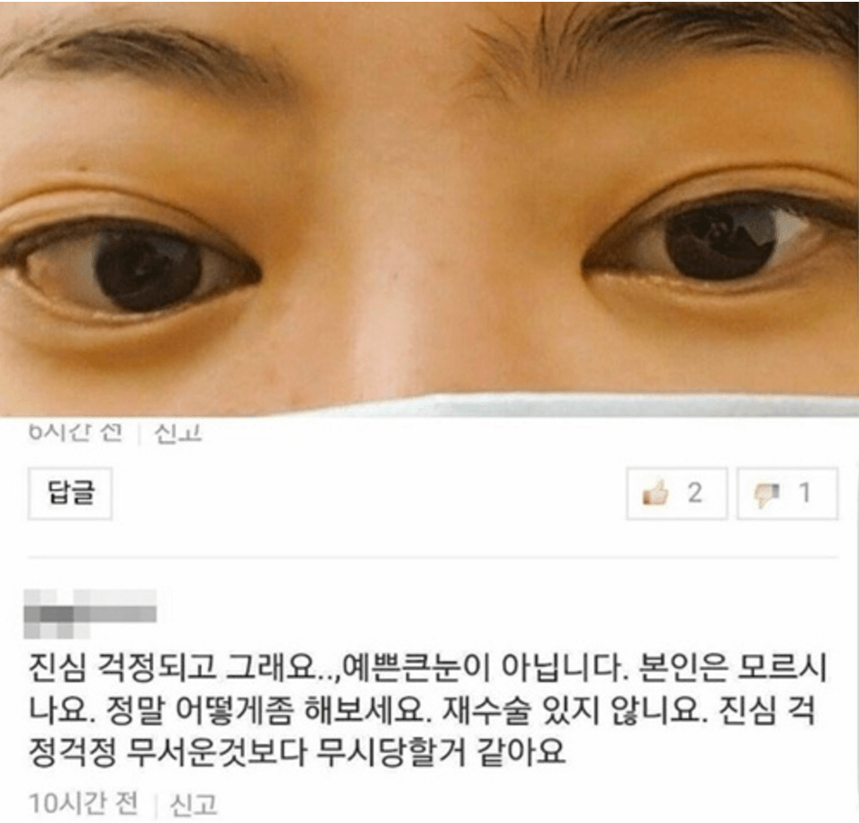Comment: I'm honestly worried for you...your eyes don't look pretty because they're bigger. Don't you know this? Can you do something about it , you can get them re done. I'm seriously worried it's not that they're scary I think people will begin making fun of you
