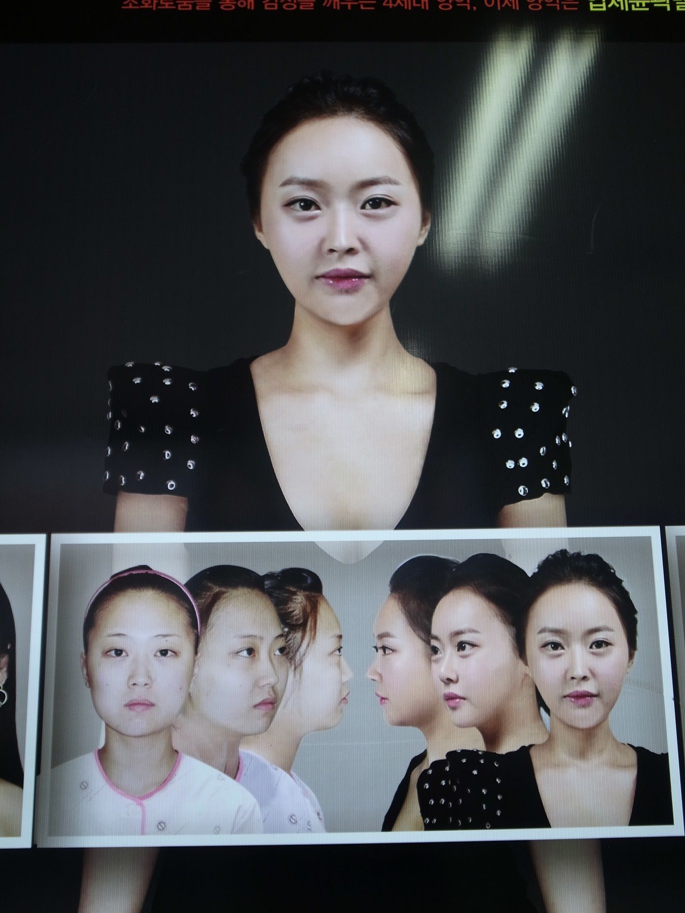 Plastic surgery clinic in Seoul makes art out of patients' jaw bones