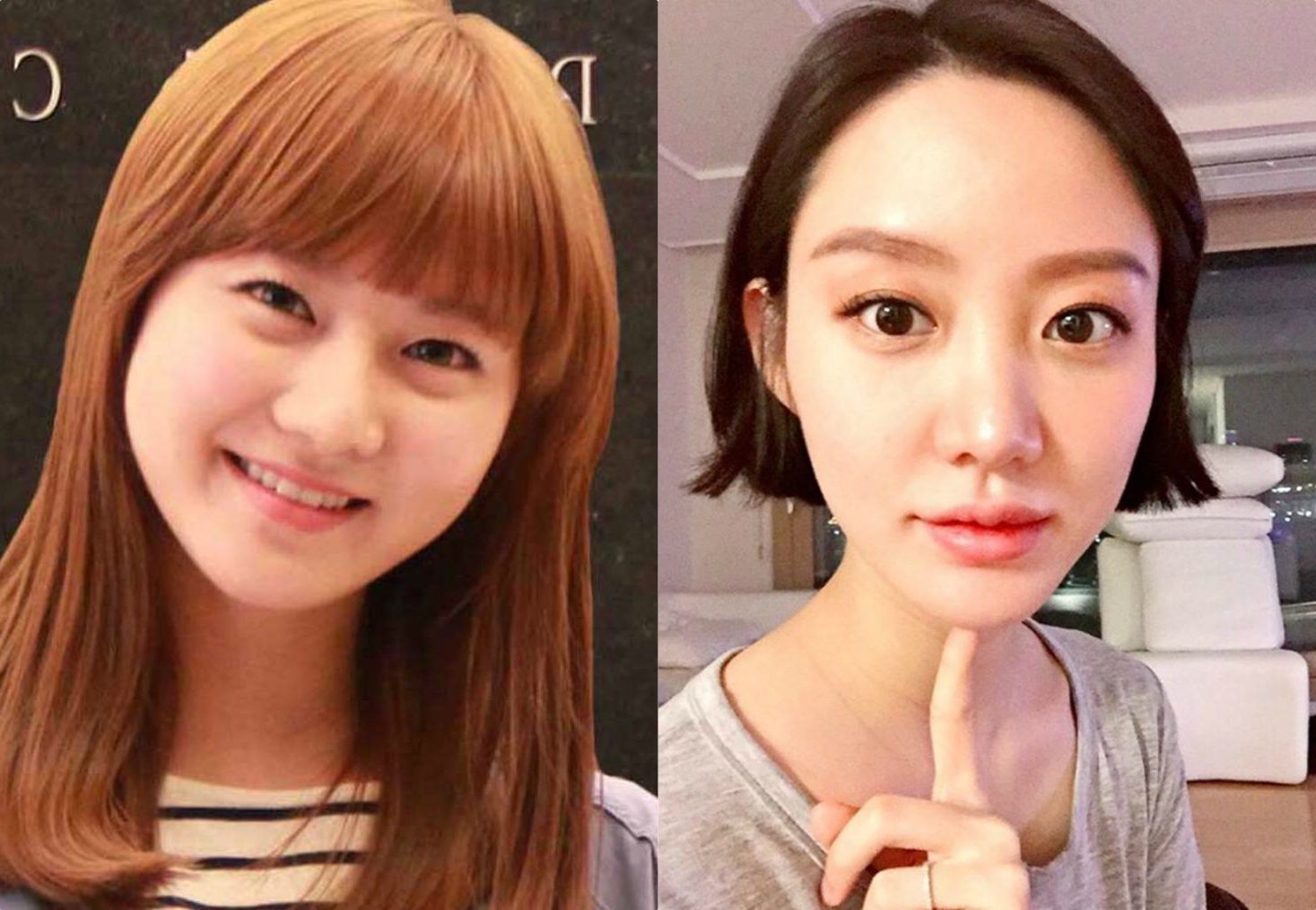 3 Female Idols That Confessed They Had Plastic Surgery But