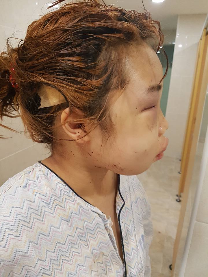 14-year-old-korean-girl-brutally-attacked-by-5-students