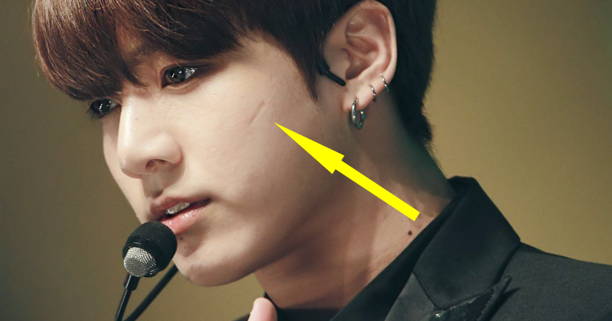 5+ Idols With Scars You Never Knew About, And How They Got